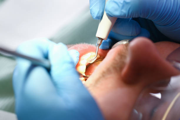 Best Emergency Tooth Extraction in Bentonville, AR