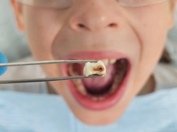 Best Pediatric Emergency Dentist in Bentonville, AR
