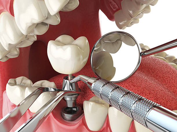 Best Emergency Treatment for Toothache in Bentonville, AR